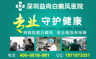 深圳什么因素能导致白癜风复发