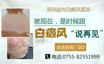 深圳市专治白癜风医院解读青少年白癜风的饮食要注意哪些事项