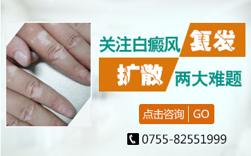 深圳有那个正规医院看白癜风病？要从哪些方面预防白斑复发